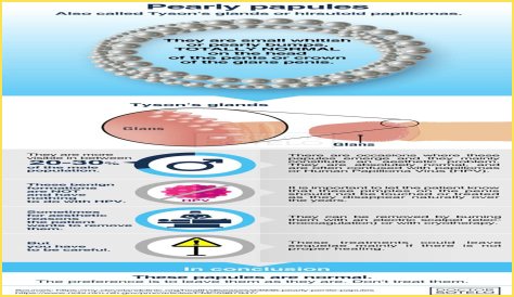 Can you Squeeze Pearly Penile Papules? Be Cautious of Scarring